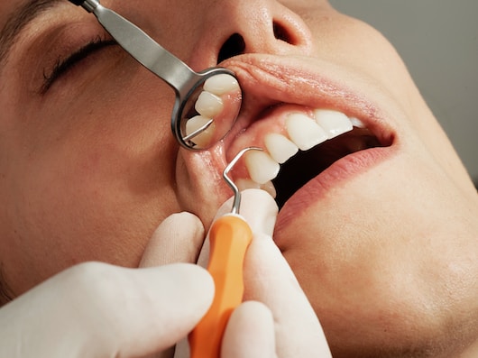 Care of your Teeth